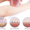 IPL Laser Hair Removal Handset - Image 7